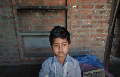 टीचर के मार से बच्चे का टूटा हाथ,शरीर पर चोट के निशान।