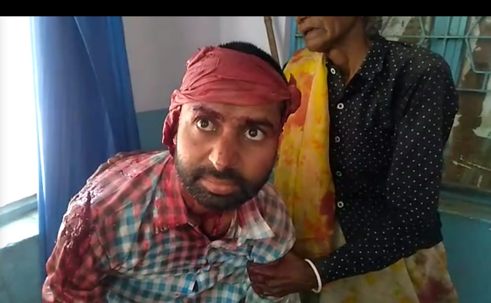 तेज रफ्तार बाइक फिसलने से बाइक सवार युवक घायल 