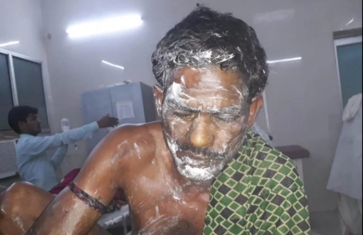 सोए हुए दंपती पर रंजिश में फेंका तेजाब